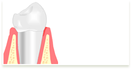 GIF lasers animated GIF on GIFER by Adorandis