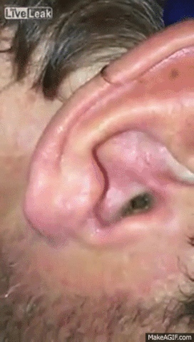 5W2q.gif