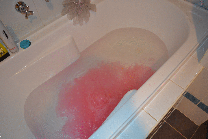 Аллергия на бомбочки для ванны у ребенка фото
