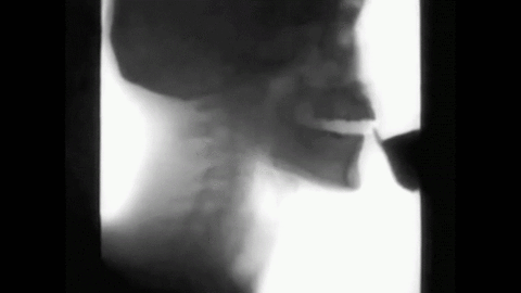 Throat 18. Рентген глубокой глотки. Рентген анимация. Рентген гиф.