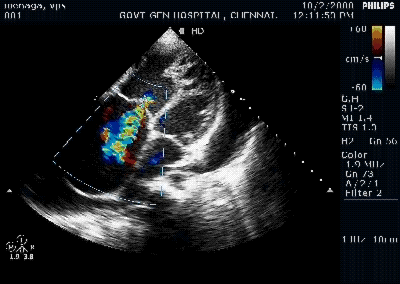 GIF echo - animated GIF on GIFER