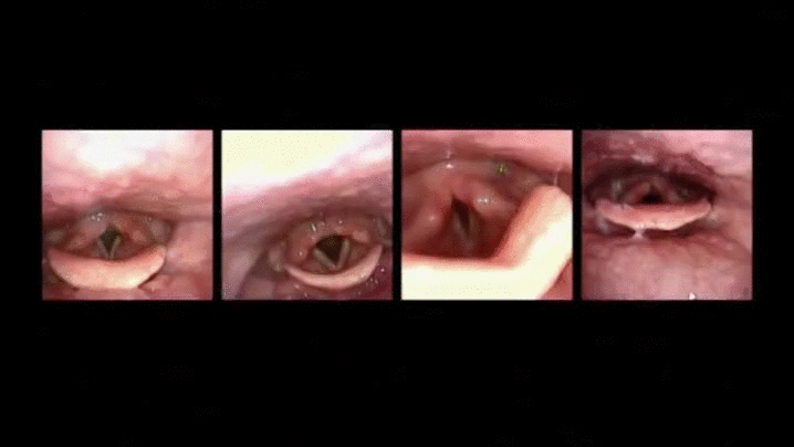 glubokoe-proniknovenie-chlenom-v-gorlo-smotret-video-porno-ne-skachivat