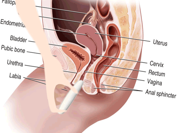 Animated Insertion Urethra Gif Porn Gifer