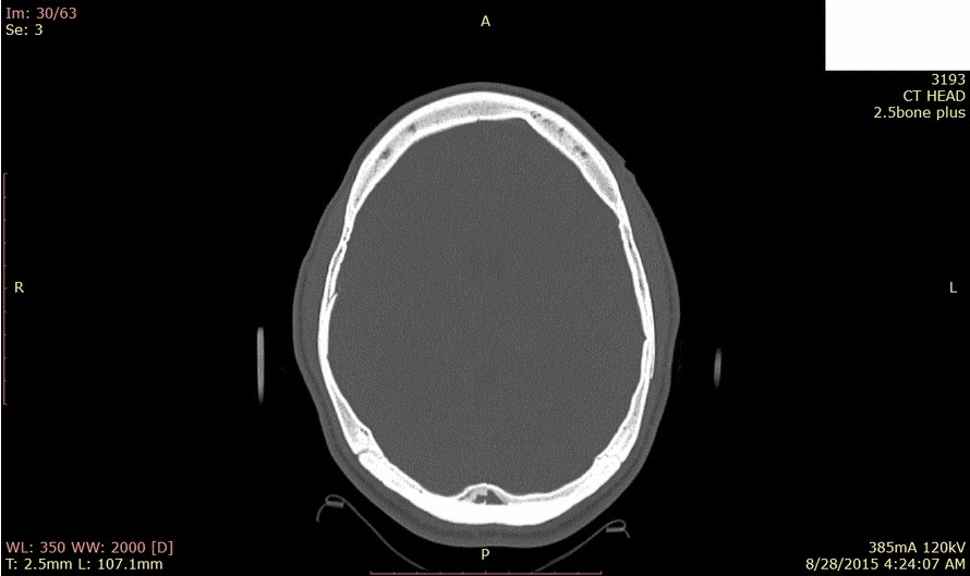 Head skull GIF Find on GIFER