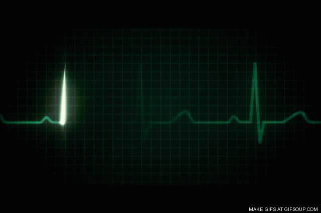 Пульс без движения. Гиф остановка сердца на кардиограмме. Пульс. Прямая линия на кардиограмме. Кардиограмма gif.