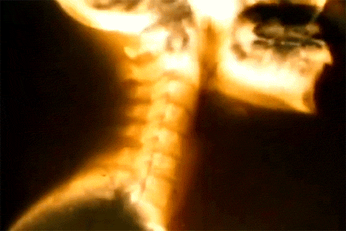 Боль в голове. Причины головной боли. Пульсирует подборка. Головной мозг анимация. Пульсирует подборка.