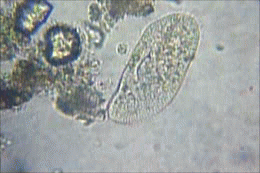 paramecium,microorganism,microscopic,biology,protist,microphotography,diatom,science,nature,microscope,microbiology,microscopy,pond life