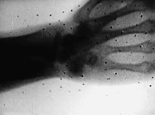 x ray,bone,skeleton,black and white,halloween,bones,spooky,wrist