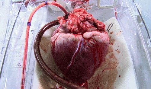 wtf,weird,heart,beating,transplant