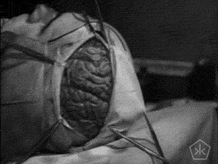 tv,art,movies,film,black and white,vintage,science,artists on tumblr,cinemagraph,bw,cine,doctor,brain,die,experiment,okkult,excerpts,1962,motion pictures