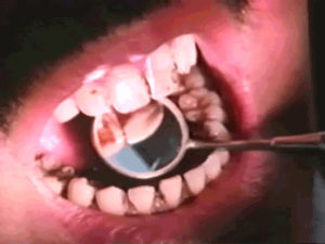 teeth,dentist,tooth decay,my lucky stars,ew,vhs,gross,oc,mustache,mipi,lol hir anon tho