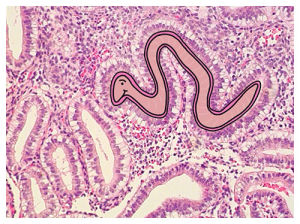 parasite,histology,parasitology,biology,worm,gastrointestinal,science,intestines,hookworm