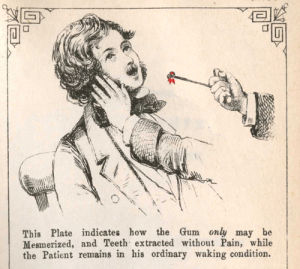 19th century,pulling teeth,halloween,hypnosis,gifitup,internet archive,dpla,page frights,tooth extraction,medical heritage library,chad fisher,scott spicoli,francis a countway library of medicine