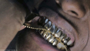 asap rocky,gold teeth,peso,gold,aap,grills