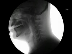 drinking,person,xray