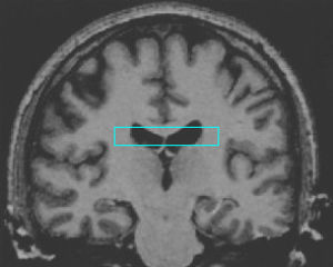 GIF computer vision - animated GIF on GIFER