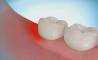 Extraction Animated Extraction GIFs - Get the best gif on GIFER