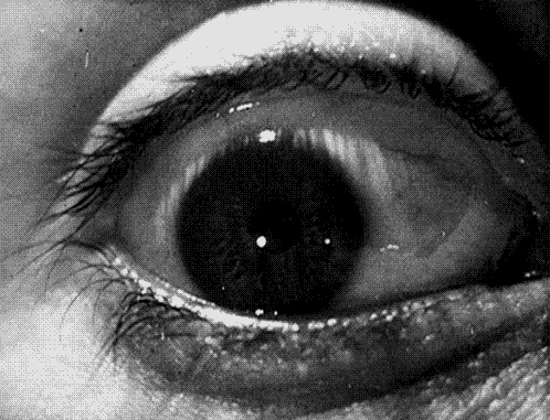 Gif eye