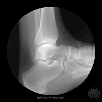 Xray GIFs - Get the best gif on GIFER